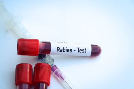 Rabies test to look for abnormalities from blood, scientific experimentの写真素材
