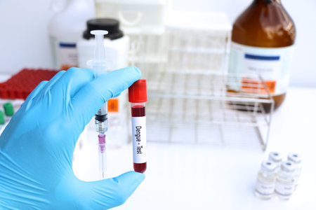 Dengue test to look for abnormalities from blood, scientific experiment