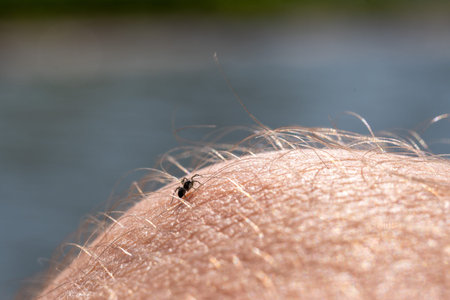 The little spider got tangled up in the hair on his leg.