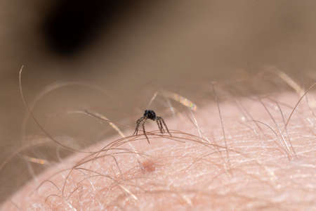 The little spider got tangled up in the hair on his leg.の写真素材
