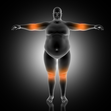 3D render of a medical background of overweight male with elbow and knees highlightedの写真素材