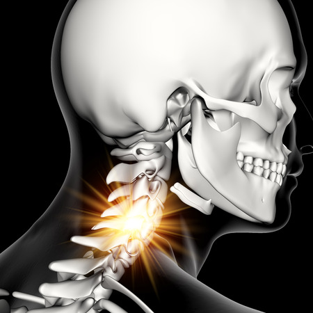 3D render of a male medical figure with neck bones highlightedの写真素材