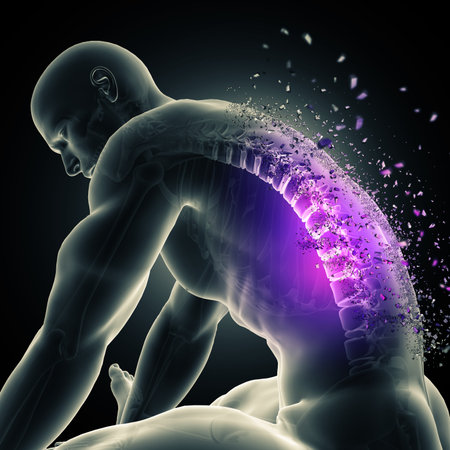 3D render of a male figure leaning over with spine highlighted and shatteringの写真素材