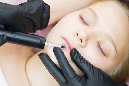 The cosmetologist makes microinjections, takes care of the patient with the help of a derma pen. Alcohol-free lip augmentation. hyaluron penの写真素材