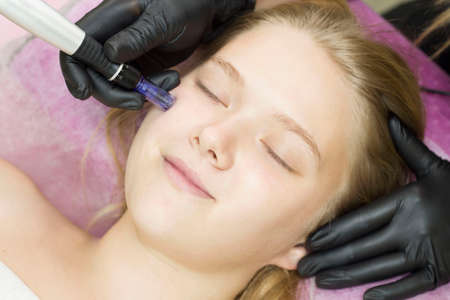 Needle mesotherapy. Cosmetologist performs needle mesotherapy on a womans face. Beautiful woman receiving microneedling rejuvenation treatment. Needle liftingの写真素材