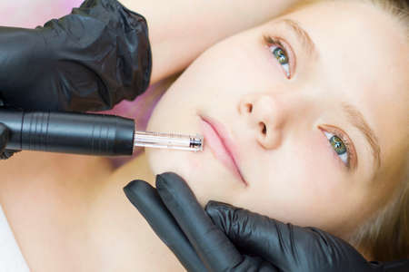 The cosmetologist makes microinjections, takes care of the patient with a leather pen. Lip augmentation is painless, without injections. hyaluronic penの写真素材