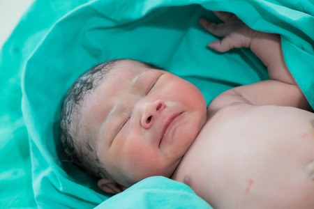 Baby , Photo therapy to infant - neonatal hyperbilirubinemiaの写真素材