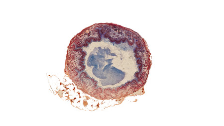 cross section of a male pine cone under the microscopeの写真素材