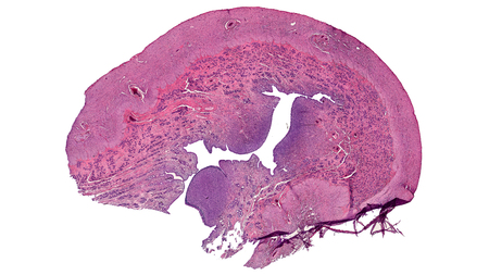 cross section cut of uterus under the microscopeの写真素材