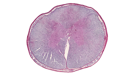 cross section cut of spinal under the microscopeの写真素材