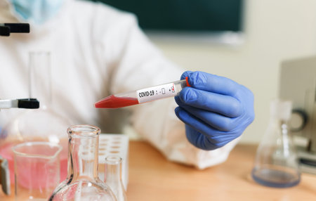 Chemist in the laboratory of coronavirus research in vitro shooting covid-19 close-up
