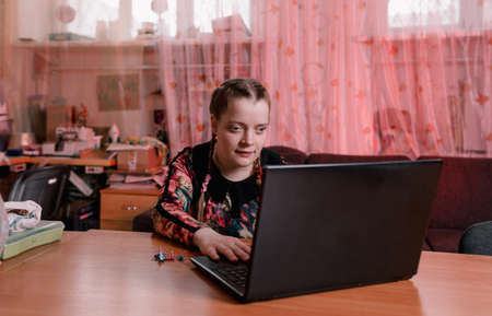 a disabled girl with slanted eyes is sitting at a desk and working on a laptop.の写真素材