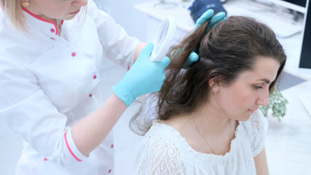 A trichologist examines the condition of the hair on the patient's head using a lens.の写真素材