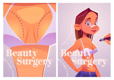 Beauty surgery cartoon posters. Woman with patch on nose prepare for plastic surgery. Doctor drawing lines on girl chest for augmentation, lipofilling cosmetics medicine procedure Vector illustrationのイラスト素材