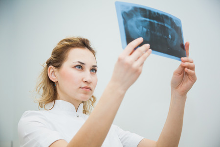 Female doctor dentist examining x-ray of human jaw. Professional stomatologist checking dental x-ray image at clinic office.の写真素材