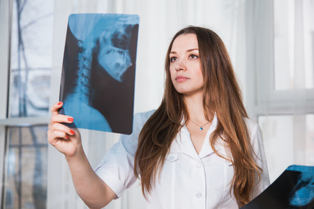 Worried medical worker with patients xray shot. Female doctor at clinic examine human scull roentgen. Medicine service head desease healthcare concept.の写真素材