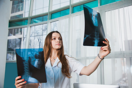 Worried medical worker with patients xray shot. Female doctor at clinic examine human scull roentgen. Medicine service head desease healthcare concept.の写真素材