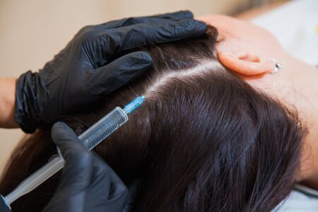 Unrecognizeble female person at trichologist office get injections in head skin. Doctors hands holding disposable syringe under patients head. Porcedure against hair loss and for skin health.の写真素材