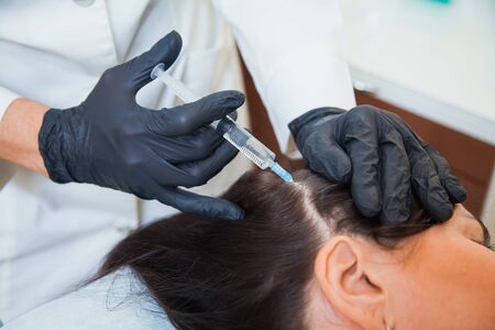 Unrecognizeble female person at trichologist office get injections in head skin. Doctors hands holding disposable syringe under patients head. Porcedure against hair loss and for skin health.の写真素材