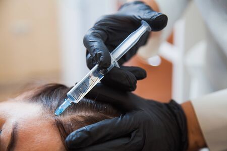 Unrecognizeble female person at trichologist office get injections in head skin. Doctors hands holding disposable syringe under patients head. Porcedure against hair loss and for skin health.の写真素材