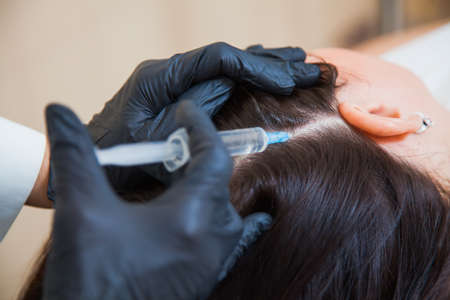 Unrecognizeble female person at trichologist office get injections in head skin. Doctors hands holding disposable syringe under patients head. Porcedure against hair loss and for skin health.の写真素材