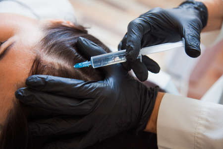 Unrecognizeble female person at trichologist office get injections in head skin. Doctors hands holding disposable syringe under patients head. Porcedure against hair loss and for skin health.の写真素材