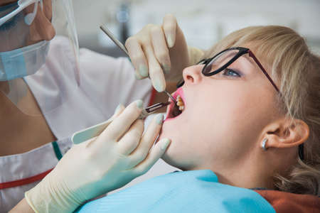 Closeup shot of dentist in protection mask working with tooth cavity and plague. Patient on stomatology chair repair aching teeth. Stomatologist and patient at clinic office. Toothcare conceptの写真素材