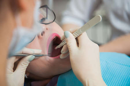 Closeup shot of dentist in protection mask working with tooth cavity and plague. Patient on stomatology chair repair aching teeth. Stomatologist and patient at clinic office. Toothcare conceptの写真素材