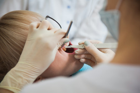 Closeup shot of dentist in protection mask working with tooth cavity and plague. Patient on stomatology chair repair aching teeth. Stomatologist and patient at clinic office. Toothcare conceptの写真素材