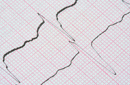 ECG graphの写真素材