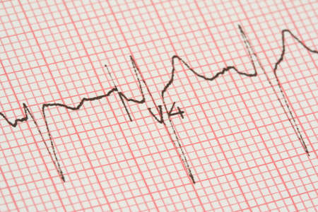ecg graphの写真素材