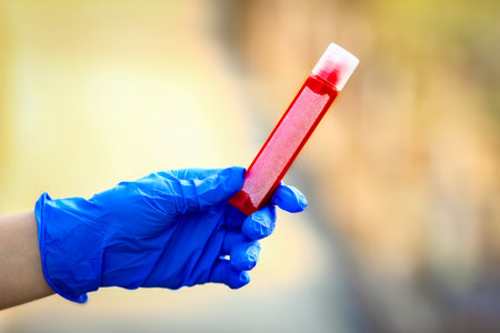 In the hands of a test tube with blood for analysis of the virus. danger to the infectious air population.の写真素材