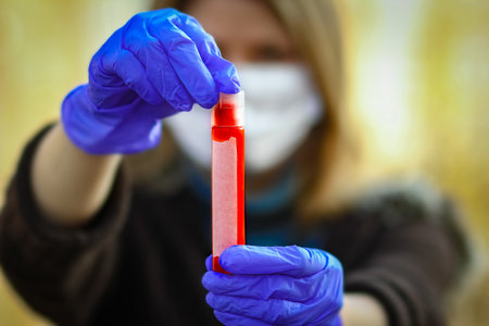 virus blood test in a girl in hands 2019-2020. Crown virus outbreak. Epidemic viral respiratory...