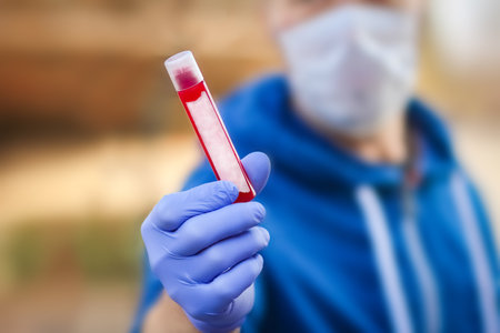virus blood test in a man's hands 2019-2020. Crown virus outbreak. Epidemic viral respiratory syndrome.の写真素材