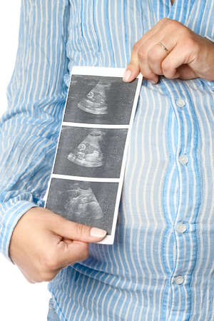 Happy pregnant girl lies on white background