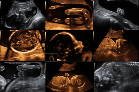 many ultrasound picture of a baby childの写真素材