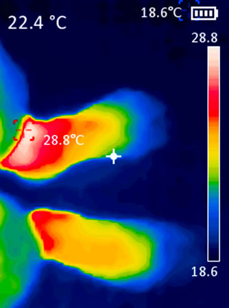 A thermographic image of a person's legs showing different temperatures in different colors, from...