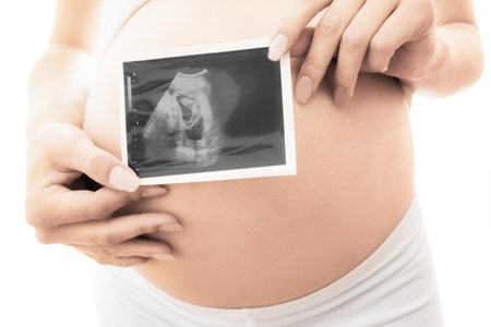 pregnant girl on a white background with ultrasoundの写真素材
