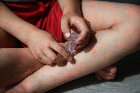 atopic dermatitis on the legs of a child treatmentの写真素材