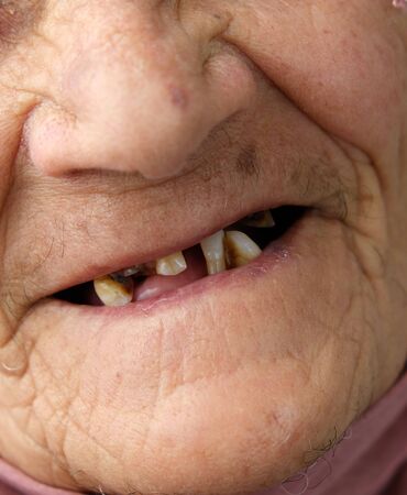 old woman without teeth, old woman with a few teeth in her mouth,の写真素材