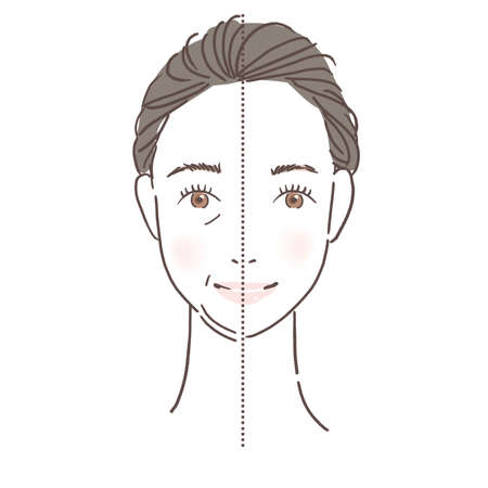 Illustration of woman with sagging skinの写真素材