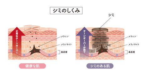 Cross section of the skin 2 frontのイラスト素材
