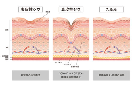 Cross section of the skin 10 frontのイラスト素材
