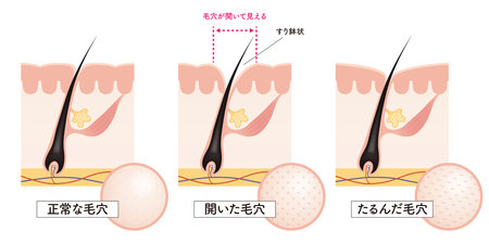 Cross section of the skin 13 frontのイラスト素材