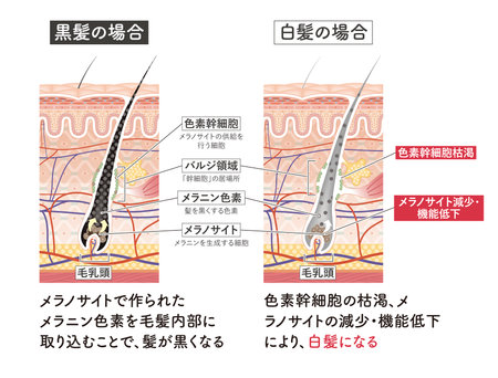 Cross section of the skin 12 frontのイラスト素材