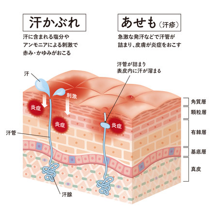 Cross section of the skin 13 front No commentaryのイラスト素材