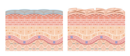 Cross section of the skin 13 front No commentaryのイラスト素材