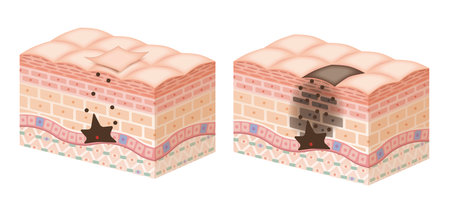 Cross section of the skin 13 front No commentaryのイラスト素材