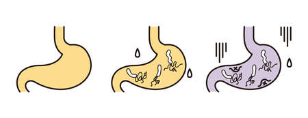 Illustration of a healthy stomach and a troubled stomach
