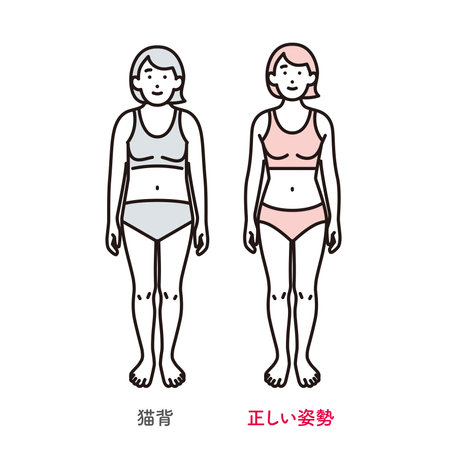 Illustration of a woman with correct posture and a woman with a stooped backのイラスト素材